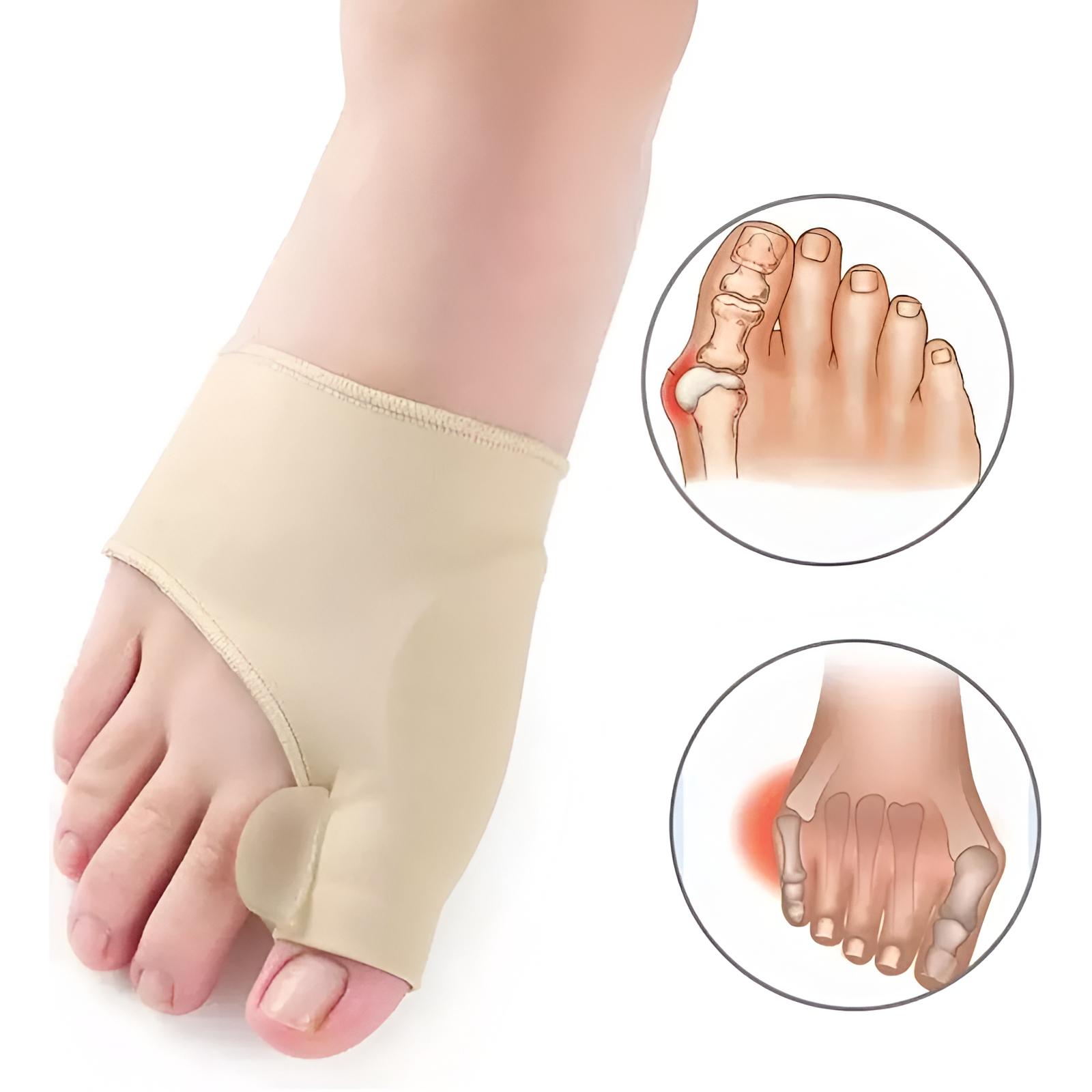 Soporte ortopédico para hallux valgus™ – (OFERTA 2X1)